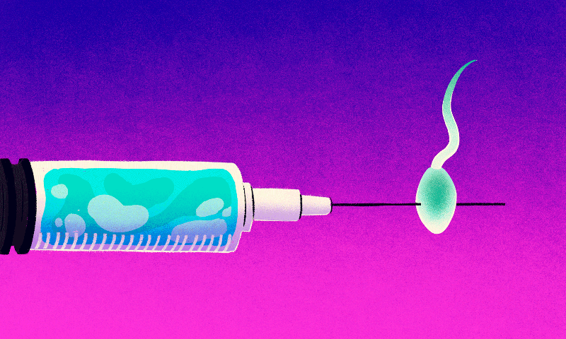 A syringe injecting through a single swimming sperm
